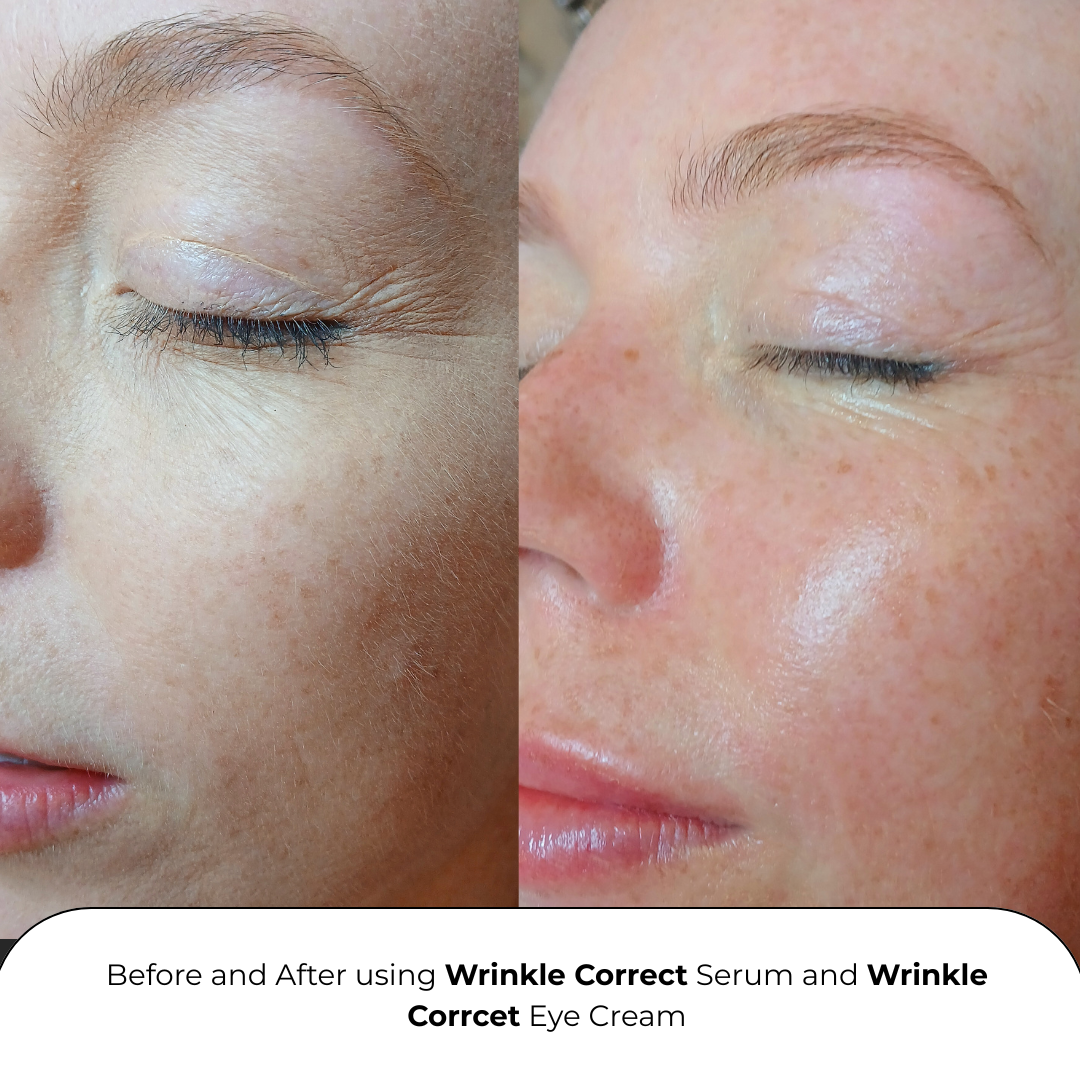 Wrinkle Correct Serum