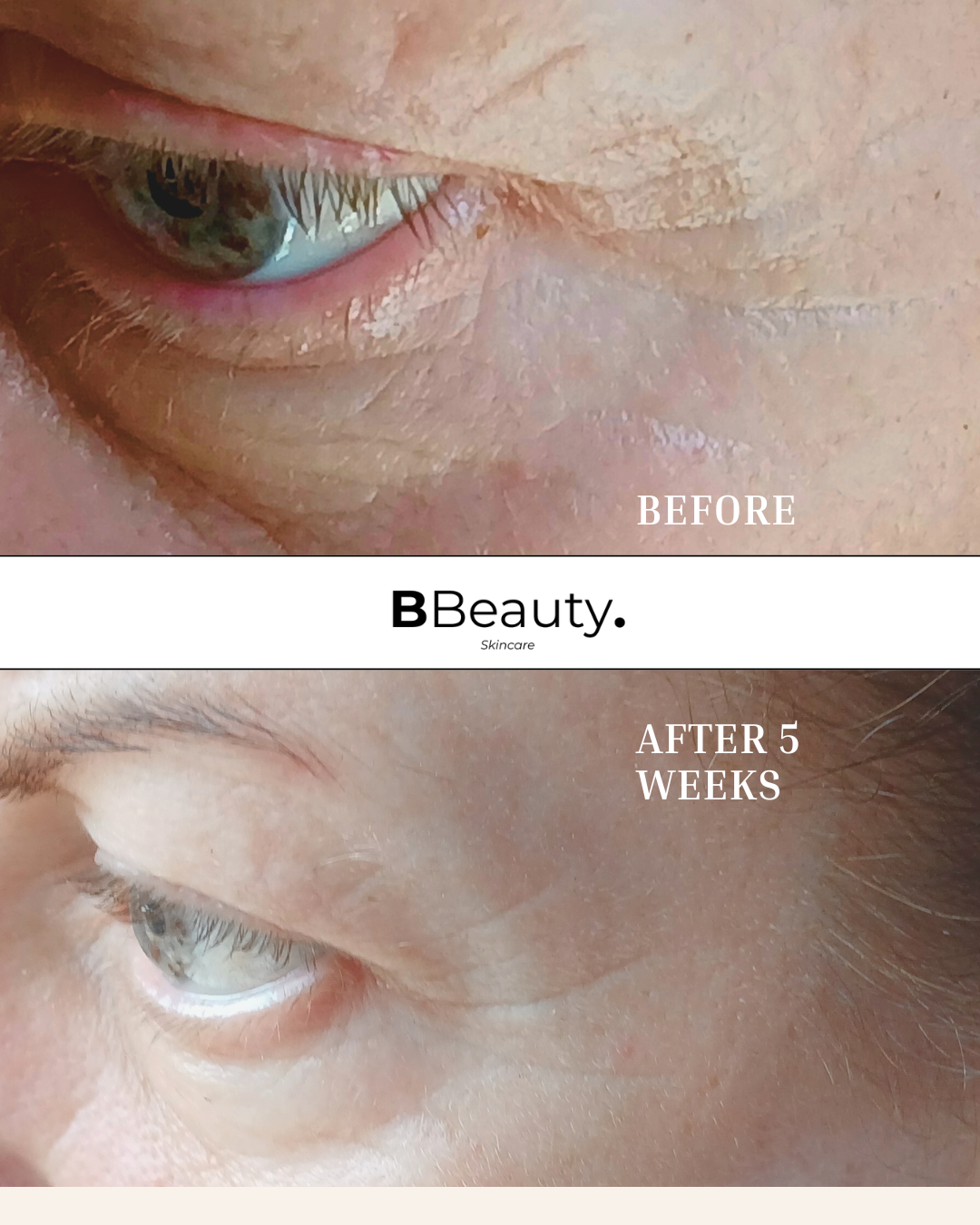 Wrinkle Correct Eye Cream