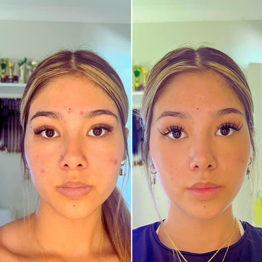Vitamin C 20% Cream